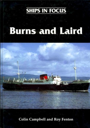 Burns and laird